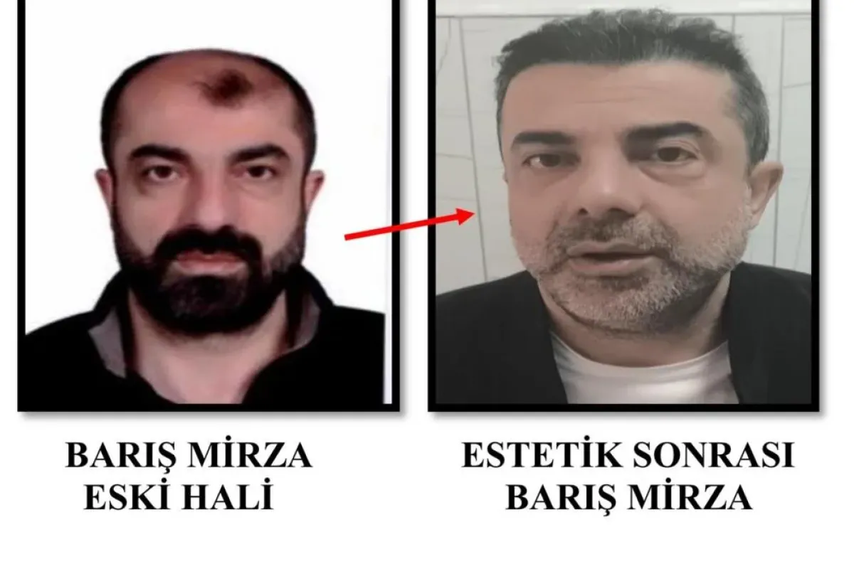 Ankara'da cinayet zanlısı yüz estetiğiyle tam 7 yıl saklandı!