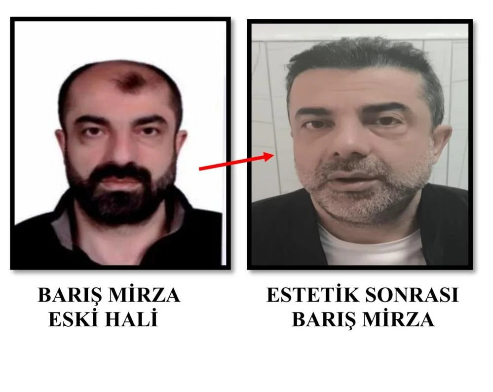 Ankara'da cinayet zanlısı yüz estetiğiyle tam 7 yıl saklandı!