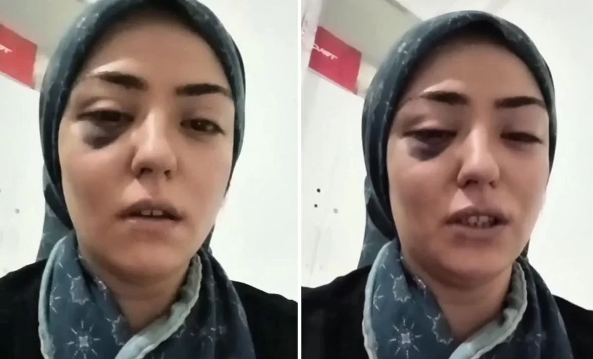 3 çocuk annesinin yardım çığlığı! "Beni kurtarın"
